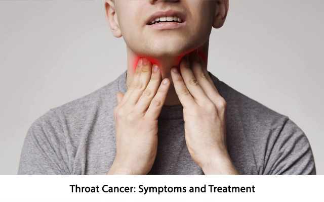Throat Cancer: Symptoms and Treatment