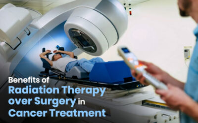 Benefits of Radiation Therapy over Surgery in Cancer Treatment