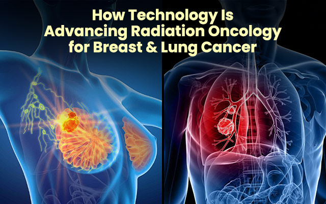 Radiation Oncology for Breast & Lung Cancer