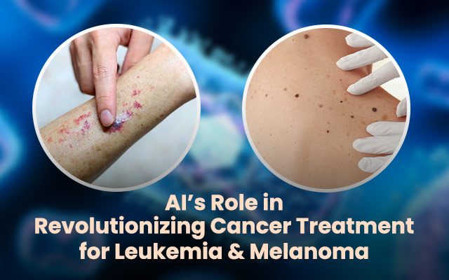AI’s Role in Revolutionizing Cancer Treatment for Leukemia & Melanoma