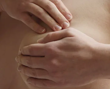 Breast Cancer and Treatment