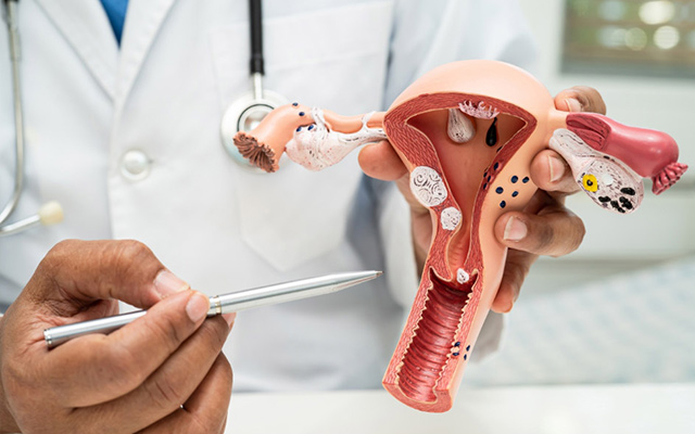 Radiation Therapy for Uterine Cancer: When Surgery Alone Is Not Enough